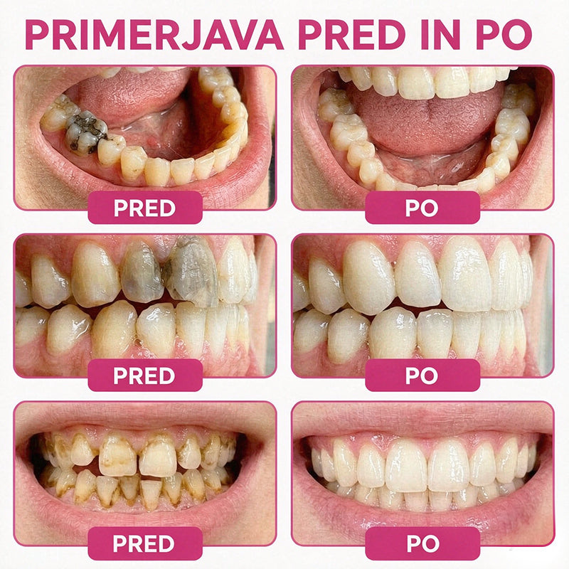 CleraNaure® DenPerm gel za obnovo kariesnih lukenj in naravno polnjenje sklenine