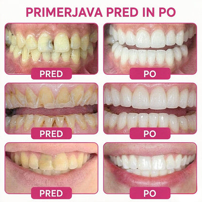 CleraNaure® DenPerm gel za obnovo kariesnih lukenj in naravno polnjenje sklenine