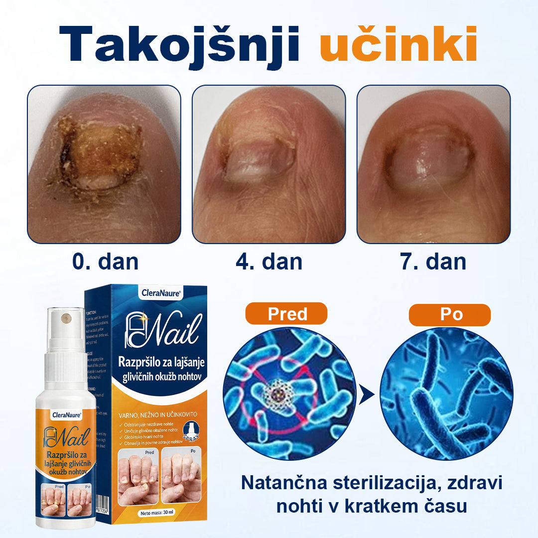 CleraNaure® sprej za lajšanje glivičnih okužb nohtov