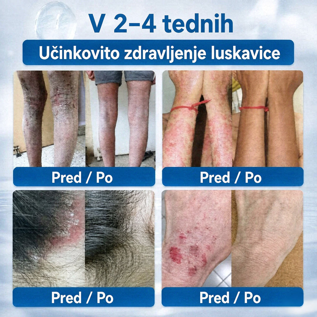 𝐂𝐥𝐞𝐫𝐚𝐍𝐚𝐮𝐫𝐞® 7-𝐃𝐚𝐲 𝐊𝐫𝐞𝐦𝐚 𝐳𝐚 𝐨𝐝𝐬𝐭𝐫𝐚𝐧𝐣𝐞𝐯𝐚𝐧𝐣𝐞 𝐤𝐨𝐳̌𝐧𝐢𝐡 𝐢𝐳𝐫𝐚𝐬𝐭𝐤𝐨𝐯 𝐢𝐧 𝐩𝐞𝐠 (𝐟𝐨𝐫𝐦𝐮𝐥𝐚 𝐛𝐫𝐞𝐳 𝐛𝐨𝐥𝐞č𝐢𝐧 𝐢𝐧 𝐛𝐫𝐞𝐳 𝐛𝐫𝐚𝐳𝐠𝐨𝐭𝐢𝐧)