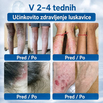 𝐂𝐥𝐞𝐫𝐚𝐍𝐚𝐮𝐫𝐞® 7-𝐃𝐚𝐲 𝐊𝐫𝐞𝐦𝐚 𝐳𝐚 𝐨𝐝𝐬𝐭𝐫𝐚𝐧𝐣𝐞𝐯𝐚𝐧𝐣𝐞 𝐤𝐨𝐳̌𝐧𝐢𝐡 𝐢𝐳𝐫𝐚𝐬𝐭𝐤𝐨𝐯 𝐢𝐧 𝐩𝐞𝐠 (𝐟𝐨𝐫𝐦𝐮𝐥𝐚 𝐛𝐫𝐞𝐳 𝐛𝐨𝐥𝐞č𝐢𝐧 𝐢𝐧 𝐛𝐫𝐞𝐳 𝐛𝐫𝐚𝐳𝐠𝐨𝐭𝐢𝐧)