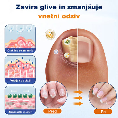 CleraNaure® sprej za lajšanje glivičnih okužb nohtov