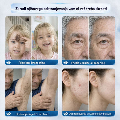 𝐂𝐥𝐞𝐫𝐚𝐍𝐚𝐮𝐫𝐞® 7-𝐃𝐚𝐲 𝐊𝐫𝐞𝐦𝐚 𝐳𝐚 𝐨𝐝𝐬𝐭𝐫𝐚𝐧𝐣𝐞𝐯𝐚𝐧𝐣𝐞 𝐤𝐨𝐳̌𝐧𝐢𝐡 𝐢𝐳𝐫𝐚𝐬𝐭𝐤𝐨𝐯 𝐢𝐧 𝐩𝐞𝐠 (𝐟𝐨𝐫𝐦𝐮𝐥𝐚 𝐛𝐫𝐞𝐳 𝐛𝐨𝐥𝐞č𝐢𝐧 𝐢𝐧 𝐛𝐫𝐞𝐳 𝐛𝐫𝐚𝐳𝐠𝐨𝐭𝐢𝐧)