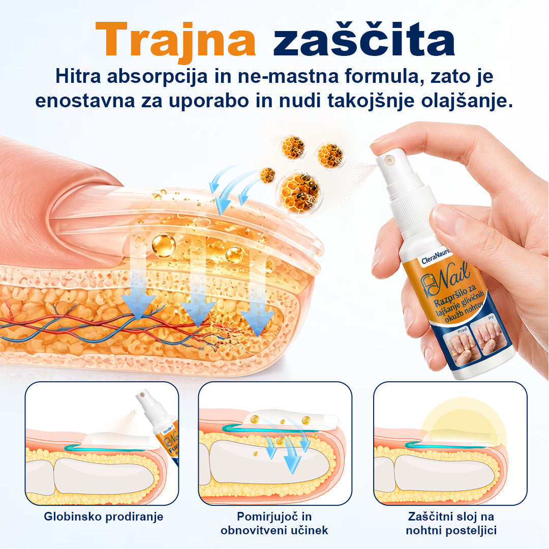CleraNaure® sprej za lajšanje glivičnih okužb nohtov