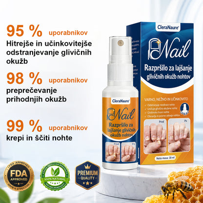 CleraNaure® sprej za lajšanje glivičnih okužb nohtov